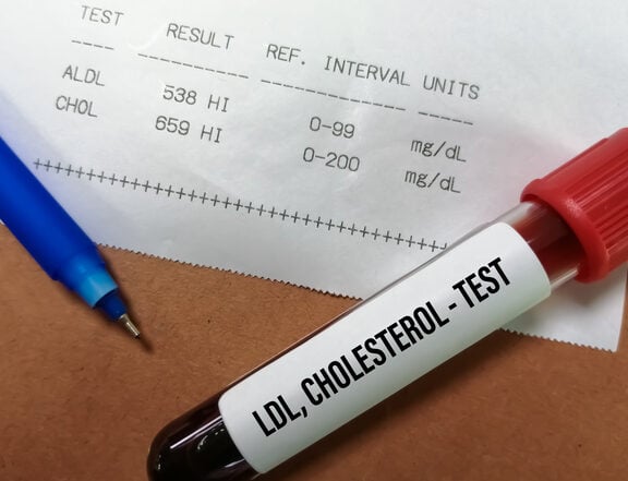 The Impact of Blood Sugar on Cholesterol Levels
