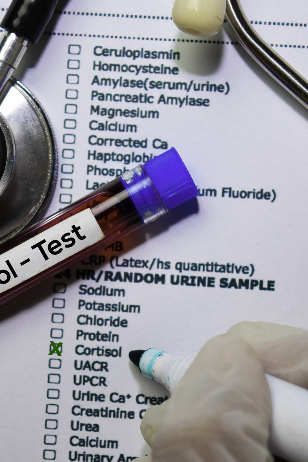Cortisol - Test with blood sample. Top view isolated on office desk. Healthcare/Medical concept