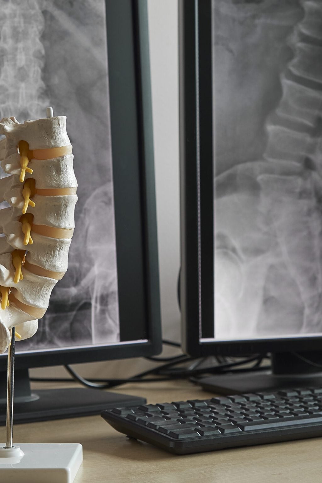 Artificial human lumbar spine model on the table with display monitor of lumbar spine x-rays